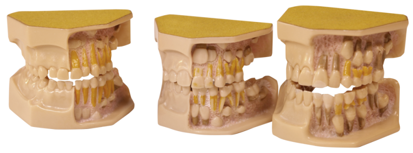 Set of 3 - Children's Developing Teeth